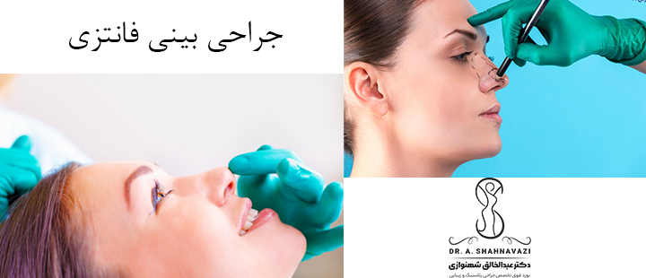 جراحی بینی فانتزی چیست؟