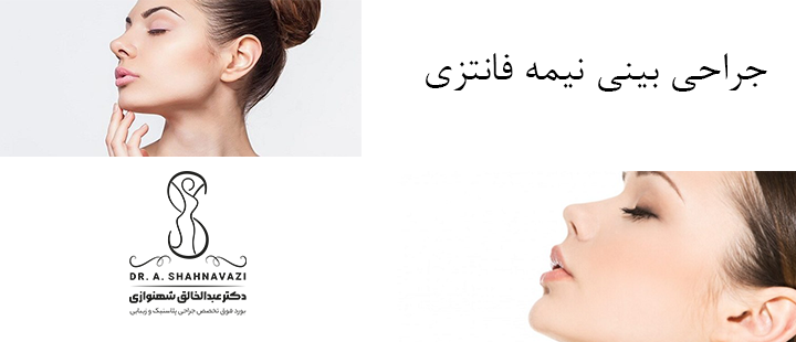 درباره جراحی بینی نیمه فانتزی