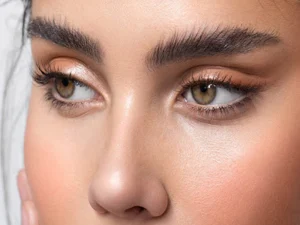 جراحی لیفت شقیقه