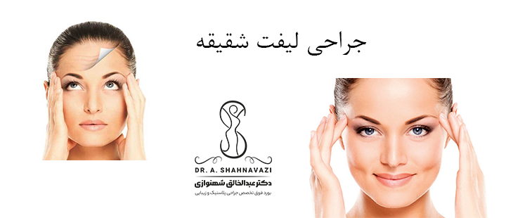 درباره جراحی لیفت شقیقه