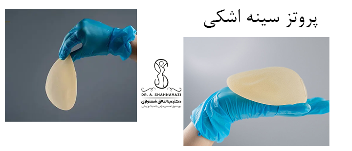 درباره پروتز سینه اشکی