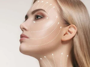 جراحی میدفیس لیفت