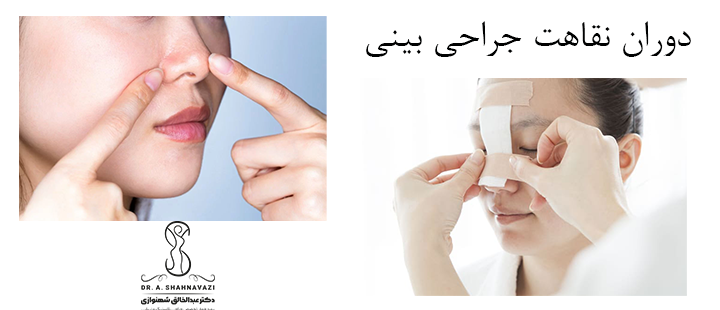 درباره دوران نقاهت جراحی بینی