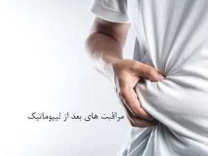 مراقبت های بعد از لیپوماتیک