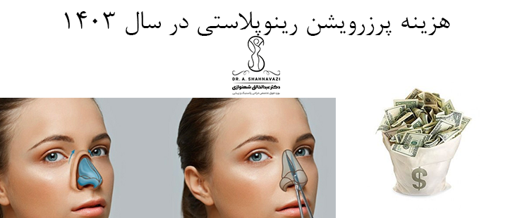 آَشنایی با هزینه پرزرویشن رینوپلاستی