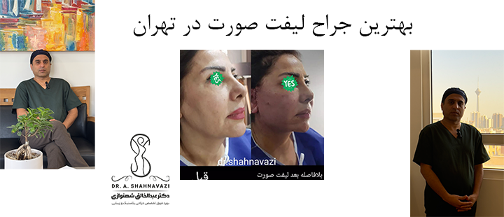 بهترین جراح لیفت صورت 