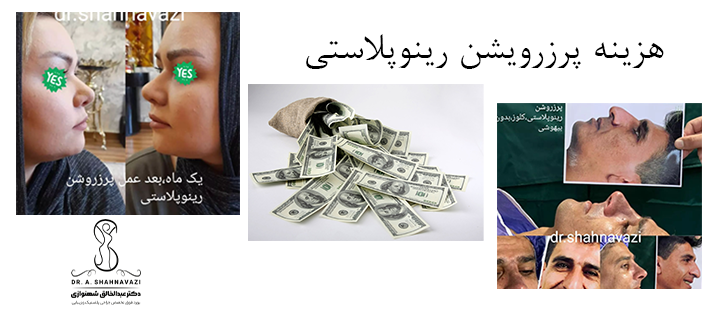 درباره هزینه پرزرویشن رینوپلاستی