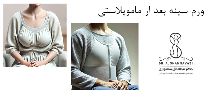 درباره ورم سینه بعد از ماموپلاستی 