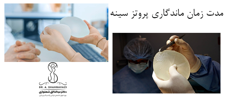 مدت زمان ماندگاری پروتز سینه