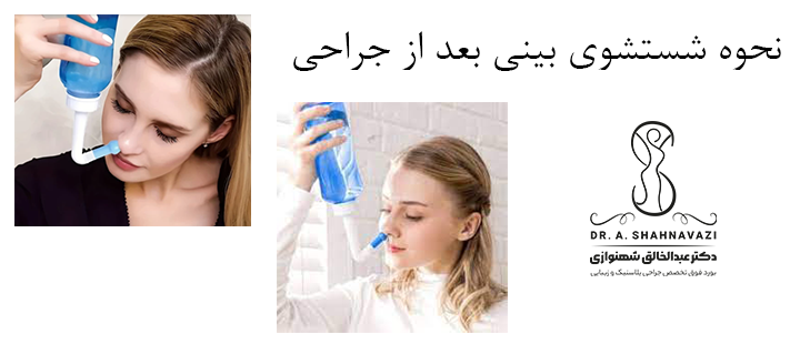 نحوه شستشوی بینی بعد از جراحی