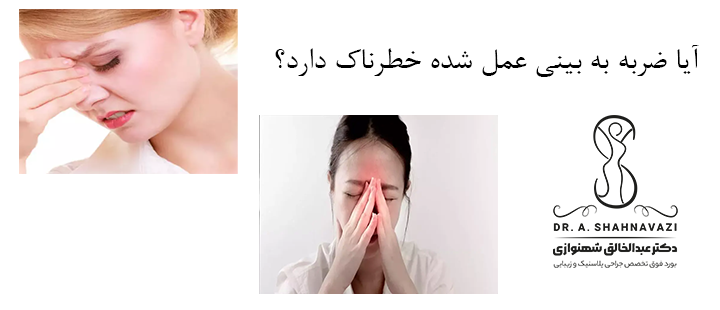 آیا ضربه به بینی عمل شده خطرناک دارد؟