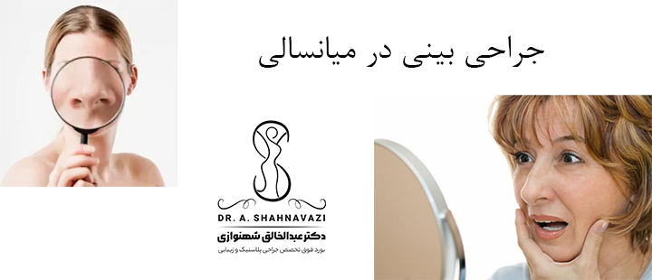 جراحی بینی در میانسالی