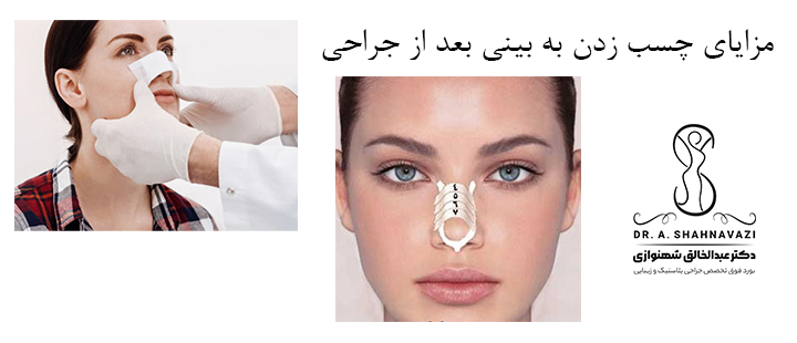 مزایای چسب زدن بعد از جراحی بینی