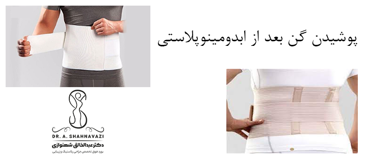 پوشیدن گن بعد از ابدومینوپلاستی 