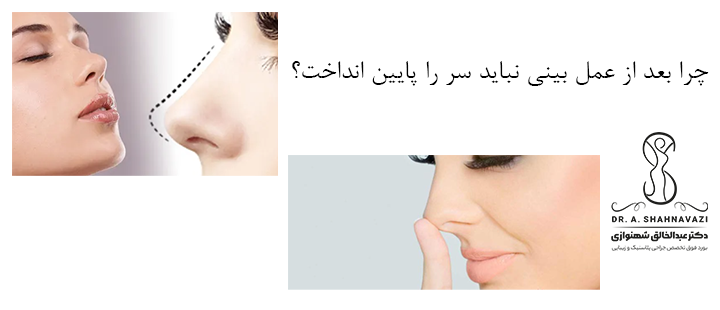 چرا بعد از عمل بینی نباید سر را پایین انداخت؟