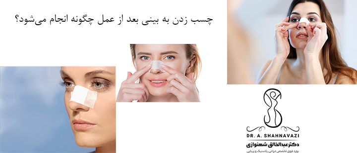 چسب زدن به بینی بعد از عمل چگونه انجام می‌شود؟