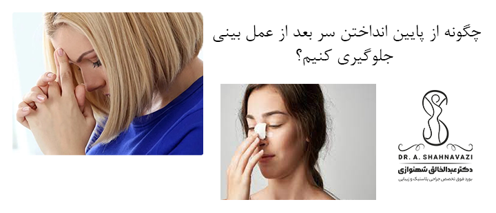 چگونه از پایین انداختن سر بعد از عمل بینی جلوگیری کنیم؟