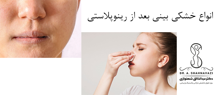 انواع خشکی بینی بعد از رینوپلاستی 