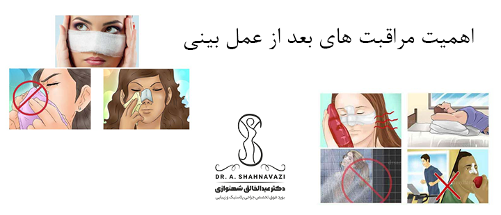 اهمیت مراقبت‌ های بعد از عمل بینی