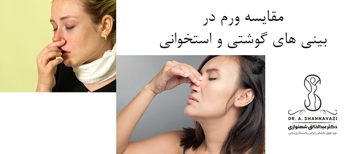 مقایسه ورم در بینی های گوشتی و استخوانی 