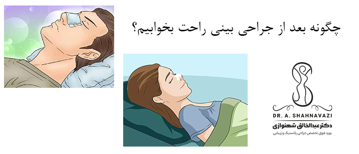 چگونه بعد از جراحی بینی راحت بخوابیم؟
