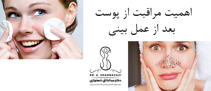 اهمیت مراقبت از پوست بعد از عمل بینی