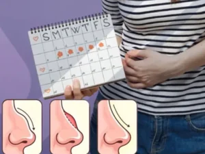 جراحی بینی هنگام پریودی