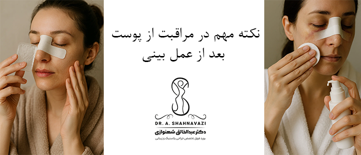 نکته مهم در مراقبت از پوست بعد از عمل بینی